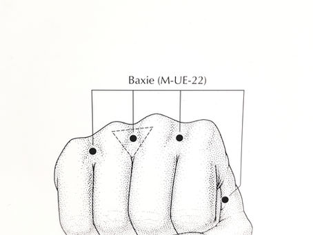Acupuncture for Rheumatoid Arthritis