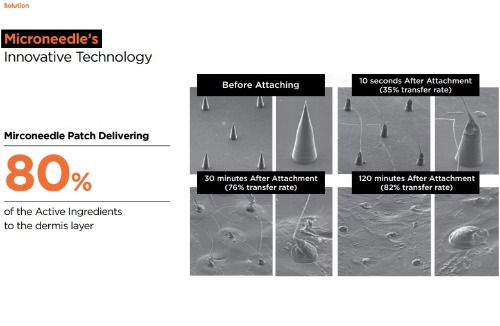 Thumbnail: NOLAHOUR  Step-1  Spot  Eraser Green