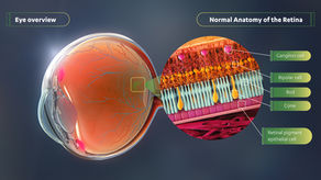 RPGR Gene Therapy Shows Statistically Significant & Continued Vision Improvement