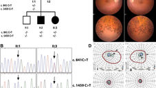 Establishing the involvement of the novel gene AGBL5 in retinitis pigmentosa by whole genome sequencing