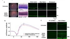Nr2e3 is a genetic modifier that rescues retinal degeneration and promotes homeostasis in multiple models of retinitis pigmentosa