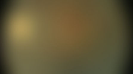 Stem Cell Therapy: Novel Approach, RP Vision Restoration