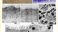 Human iPSC derived disease model of MERTK-associated retinitis pigmentosa