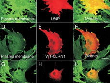 Disease-causing mutations in the CLRN1 gene alter normal CLRN1 protein trafficking to the plasma membrane