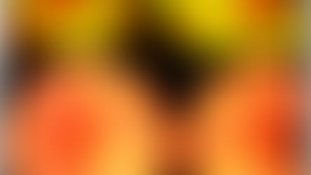 Retinitis pigmentosa associated with a mutation in BEST1