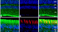 Identification and Functional Analysis of the Vision-Specific BBS3 (ARL6) Long Isoform