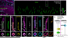 A new hope for a therapy against retinitis pigmentosa