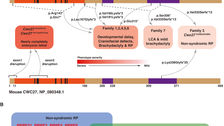 Mutations in the Spliceosome Component CWC27 Cause Retinal Degeneration with or without Additional Developmental Anomalies