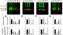 Mutation-independent rhodopsin gene therapy by knockdown and replacement with a single AAV vector
