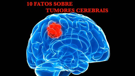 10 Fatos sobre tumores cerebrais
