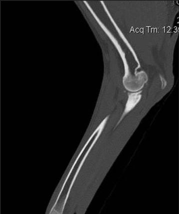 Elbow CT Scan.jpeg