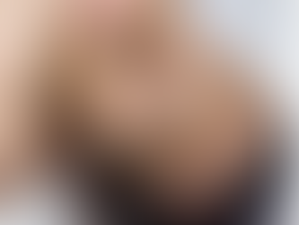 What Is Bio Spicule Microneedling? A Needle-Free Approach to Skin Renewal