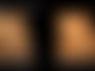 Don't be fooled by AI Editing 3D Ultrasound Images.