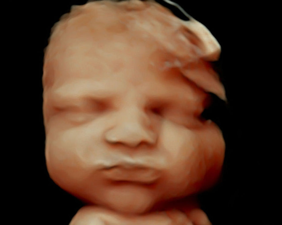 3D Ultrasound in Knoxville TN