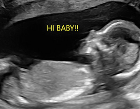 Screenshot 2026-02-15 at 1.11.10 AM.png