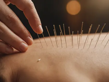 Unlocking Inner Peace: The Healing Power of Acupuncture for Post Traumatic Stress