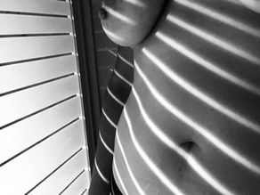 Gros plan sur un ventre strié de lumière en photothérapie par Marie HARRY photographe à Rosny-sous-bois