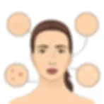An illustration of various types of acne and skin problems on the face