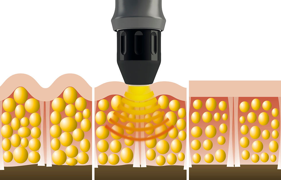 illustration.jpg