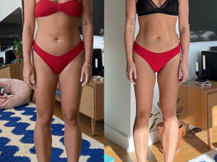 Body recomp with PCOS and insulin resistance