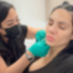 Practitioner performing a PRP facial treatment on Nina Unrated