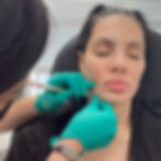 Nina Unrated receiving jawline PRP filler injection from a professional.