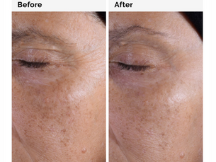Glycolic Acid Toner – Wirkung, Anwendung & Tipps für eine klare Haut (inkl. The Ordinary Glycolic Acid Toner)
