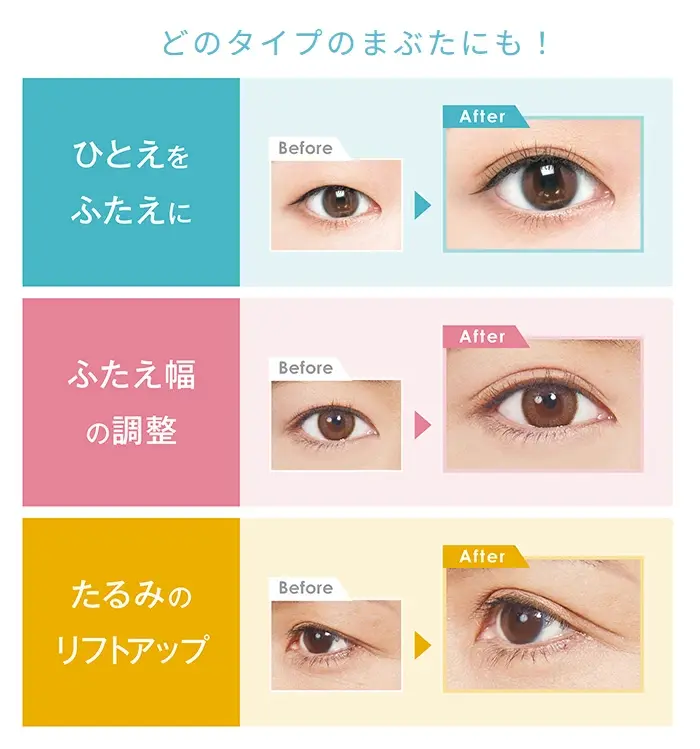 Thumbnail: D-UP Japan Orishiki Eyelid Skin Film Glue EX 4ml