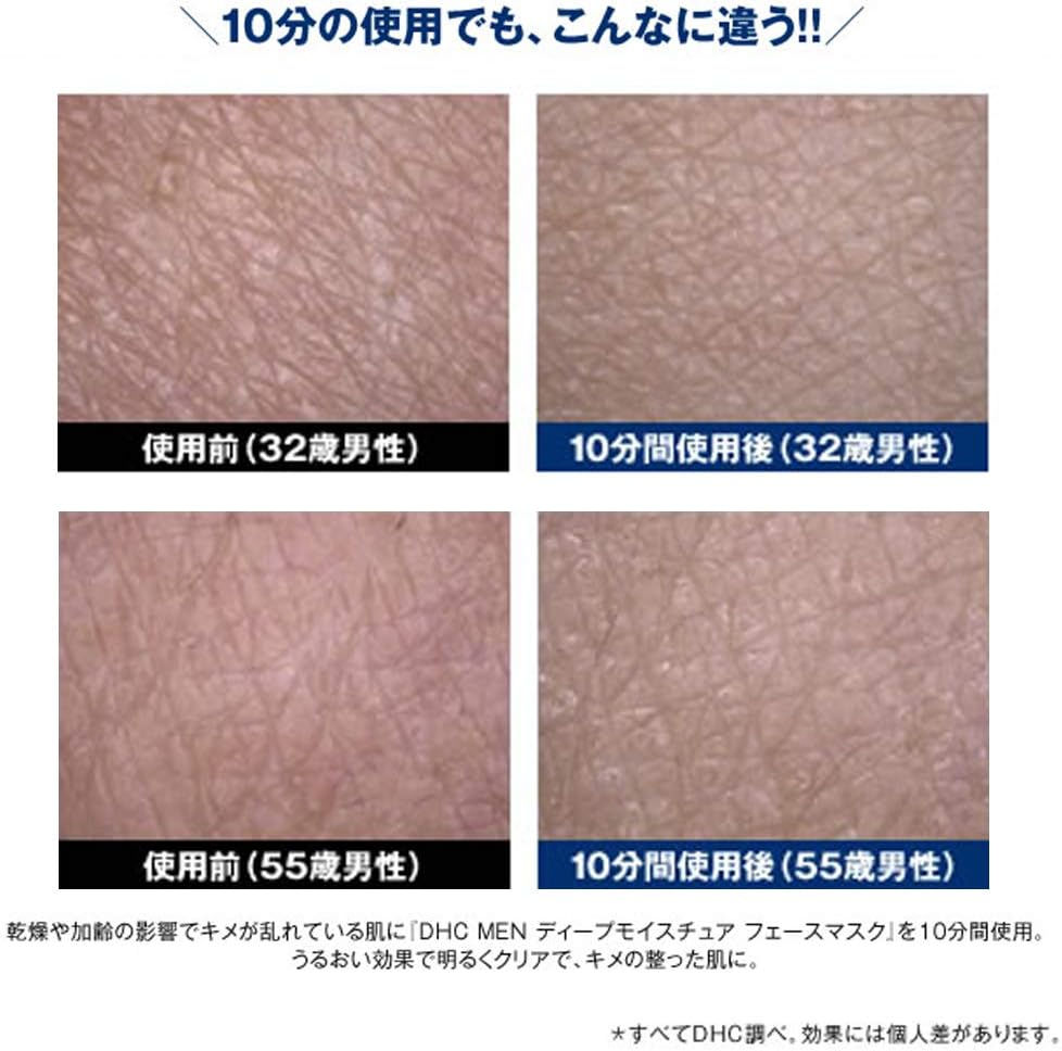 Thumbnail: 日本DHC MEN 男性深層保濕面膜 Q10 Deep Moisture Face Mask (19ml x 4片)