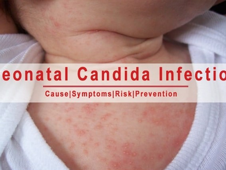 Neonatal Fungal Infections: How Birth Canal Health Affects Newborns