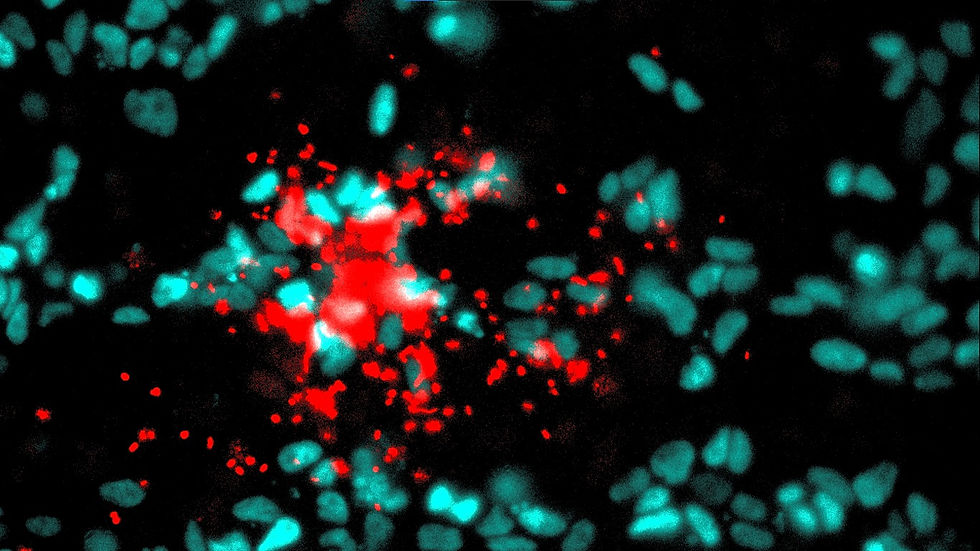 Immunoflouresent staining of epitelial cells (nuclei, blue) and Listeria monocytogenes (red). Epithelial cells form infection mount and push Listeria monocytogenes to the center of the infection focus. Eventually this extrudes the infected cells.