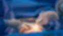 doctor-surgeon-blue-gown-puts-600nw-2285328635.webp