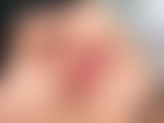 ローマピンク★リップ施術直後