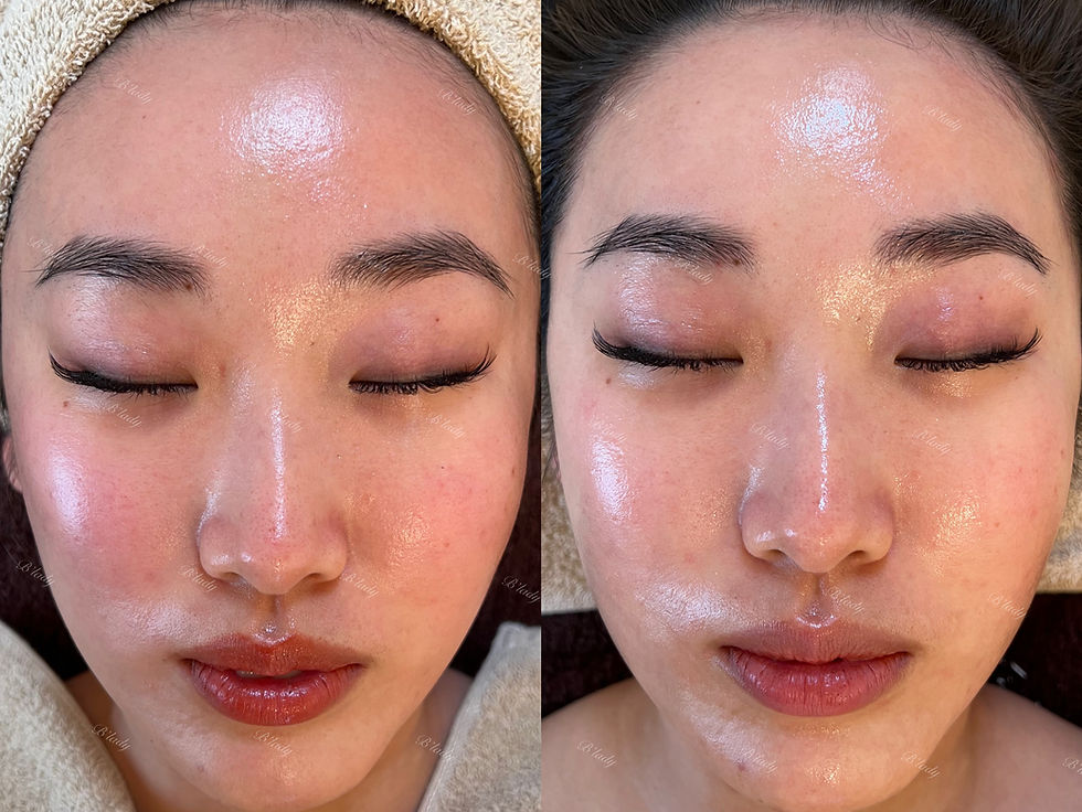 【サロンケア1回の変化】左:Before / 右:After