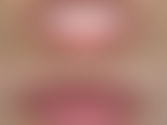 メニュー紹介:メラニン除去ケア