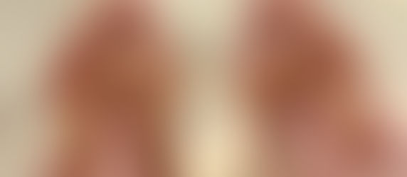 Caring for Seniors with Neuropathy — A Complete and Practical Guide