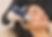 a person receiving radiofrequency microneedling treatment