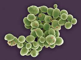Oral fungal infection (Thrush) treatment appointment