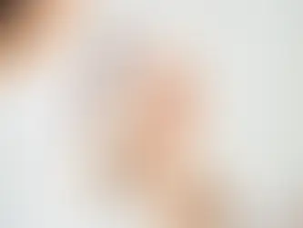What Is Facial Aesthetics and Why its better than Surgeries ?