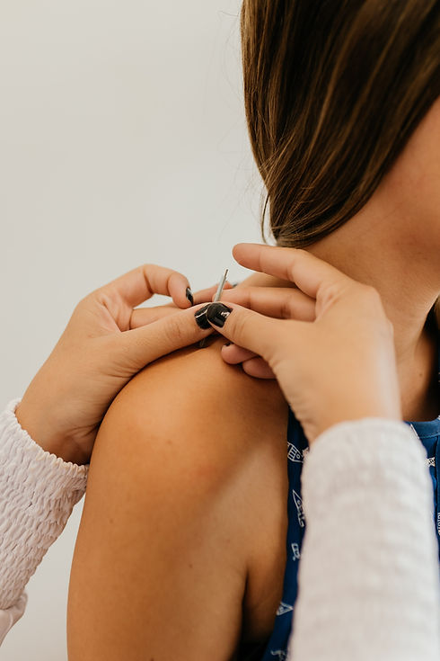 performing the dry needling technique on the shoulders.jpg