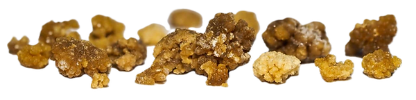 Kidney Stones_SF.png