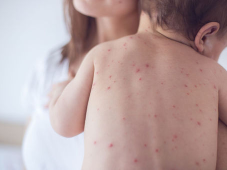 Measles in Georgia: What Parents Need to Know and How Hall Pediatrics Can Help (You Don’t Even Need to Change Pediatricians!)