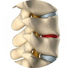non surgical spinal adjustment