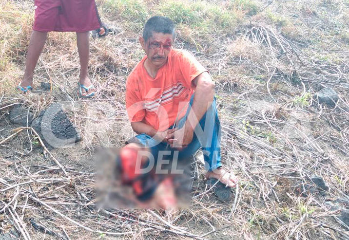 'Auto fantasma' destroza pierna a motorista en Cárdenas