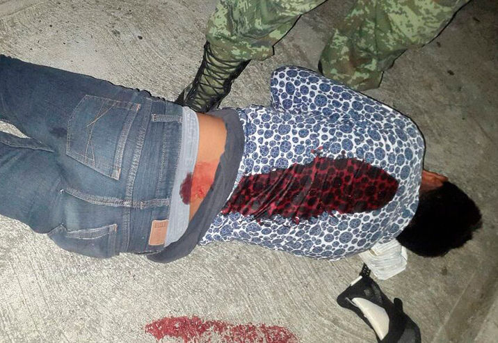 Lo balean para robarle motocicleta en Cárdenas