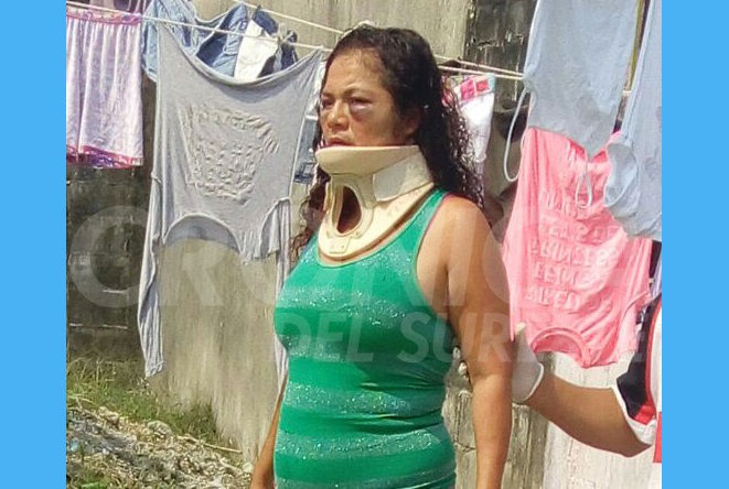 #EnCárdenas Apalea a su esposa por no darle para el trago