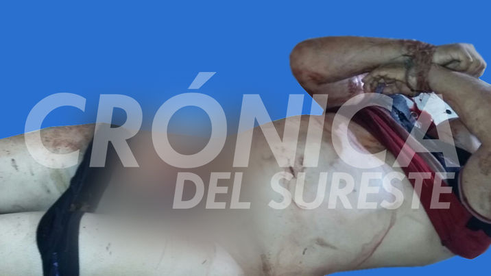 LO CAPARON!!! Localizan a sujeto entambado, torturado y sin genitales en Cárdenas