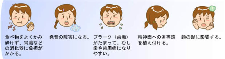 不正咬合