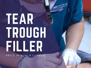RJ Clinic tear trough filler treatment in Kuala Lumpur for under-eye hollows, dark circles, and natural-looking eye rejuvenation