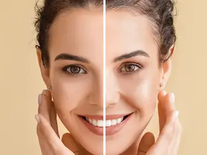 facial assymetry on women face
